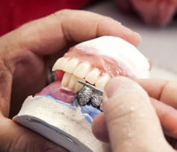 making dentures at lab