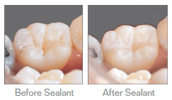 sealant sample